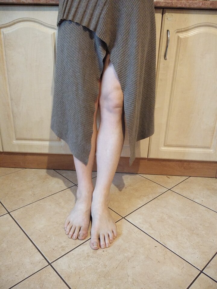 IMG_20200320_062542740.jpg - Palciusia