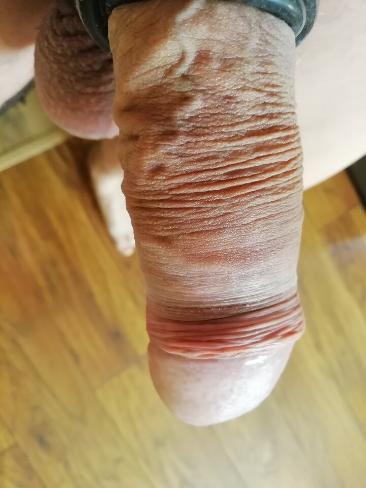 IMG_20200331_094258.jpg - wirus101