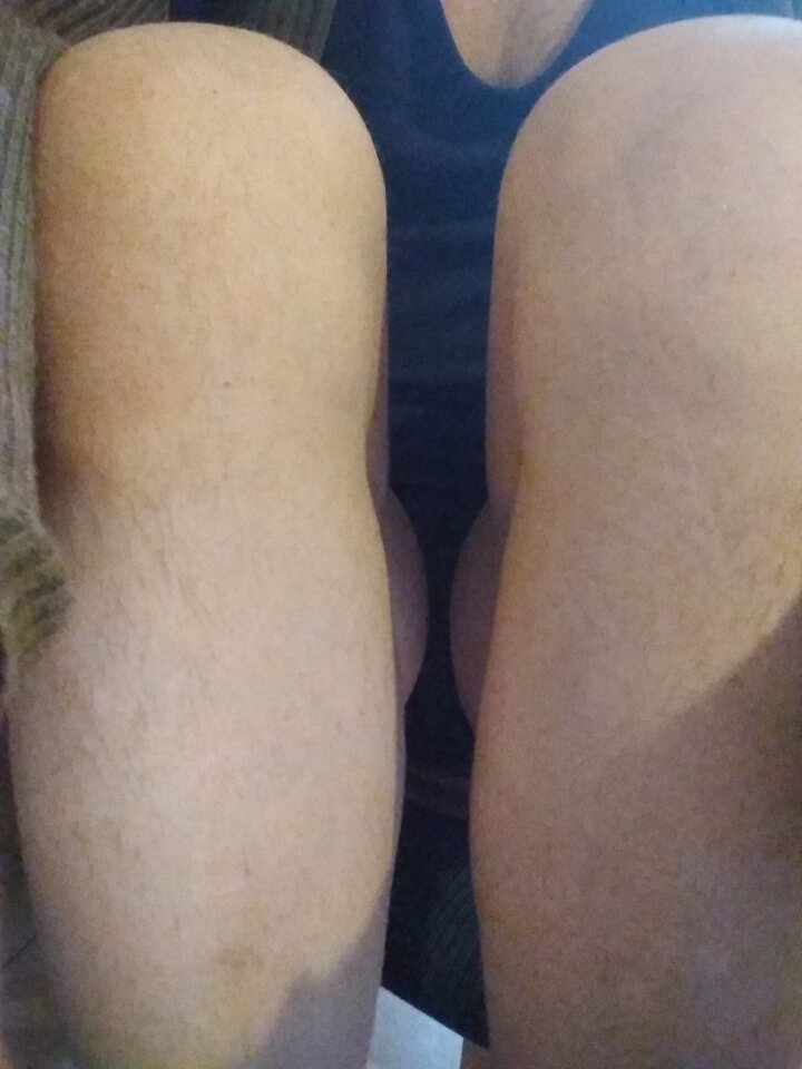 15858896644278891052096485534387.jpg - Palciusia