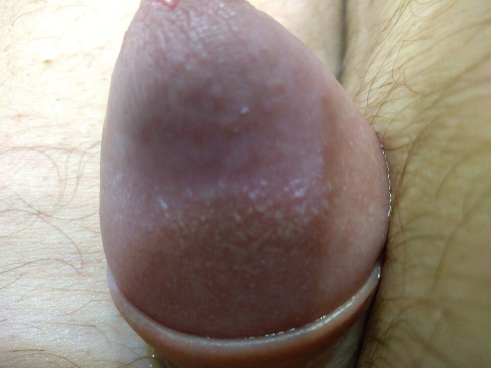 15877961076325466143262045009976.jpg - matuzalem000