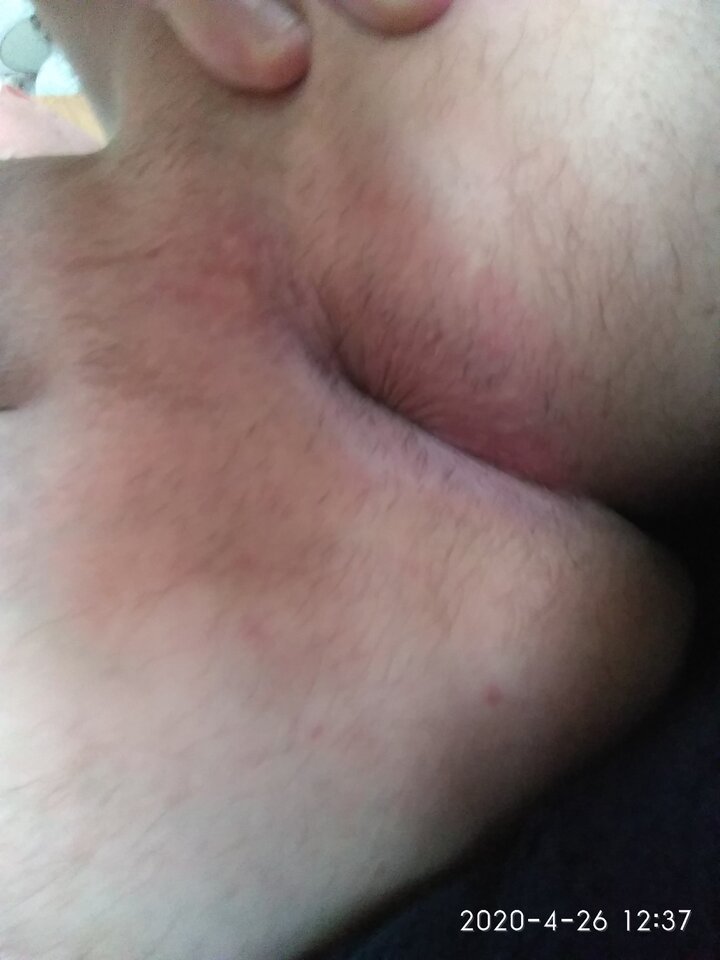 IMG_20200426_123754.jpg - 2502adrian91