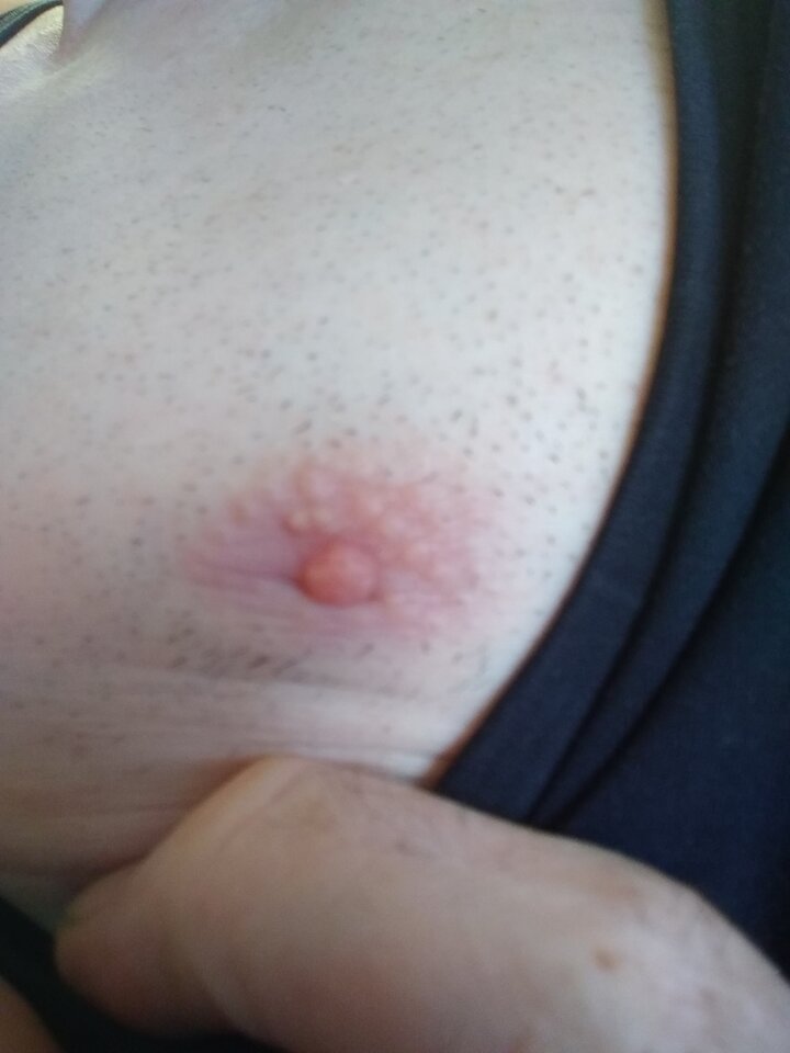 15879896113476678545986972440029.jpg - Palciusia