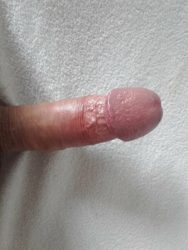 WLKPpn86