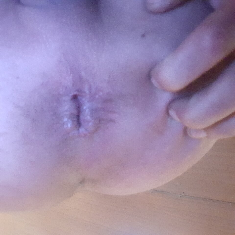 20200614_102548.jpg - Transpola