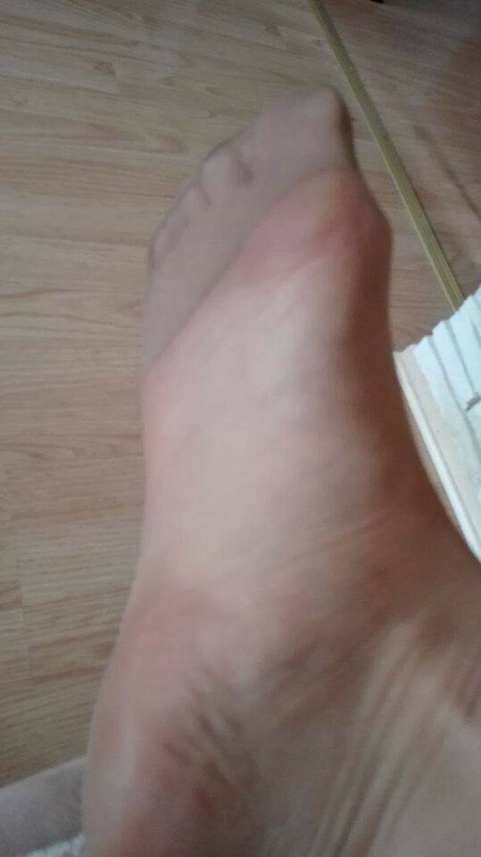 received_598258883710967.jpeg - dla_fetyszystki