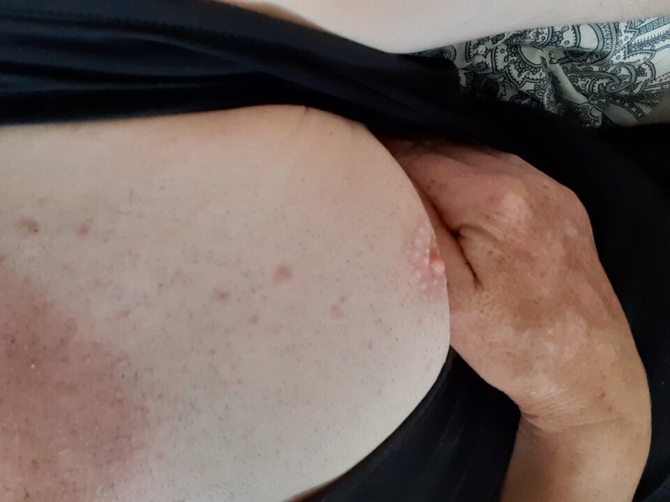 15938838411778616316190219861420.jpg - Palciusia