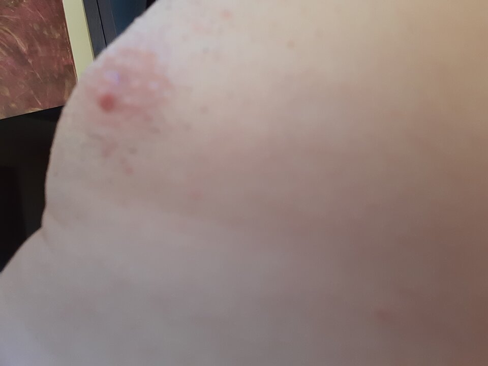 15939608640344013235532589458200.jpg - Palciusia