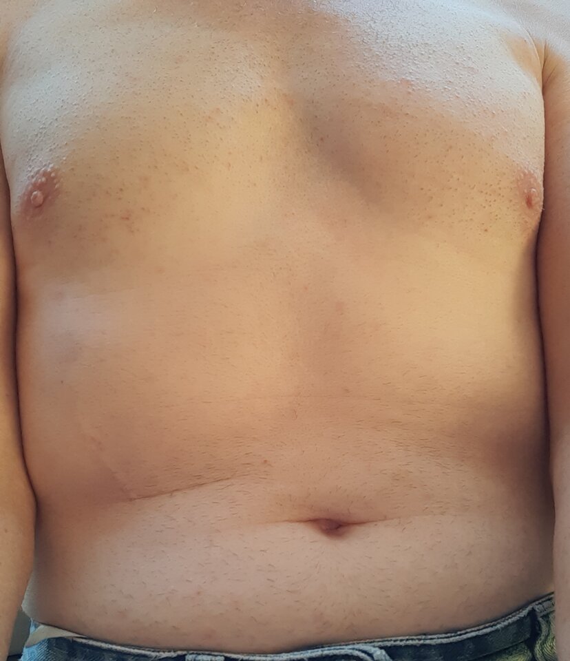 20200705_170234.jpg - Palciusia