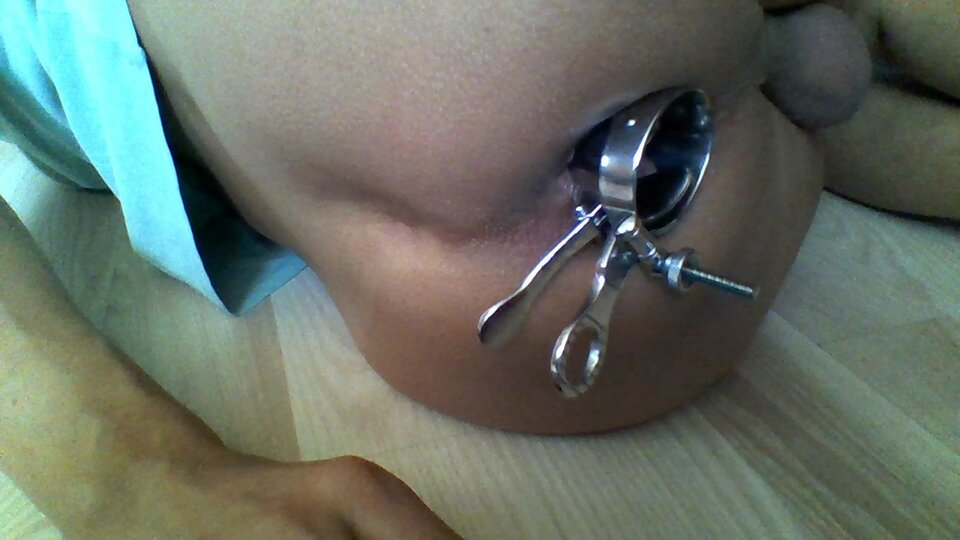 WIN_20200705_082744.JPG - martin120174