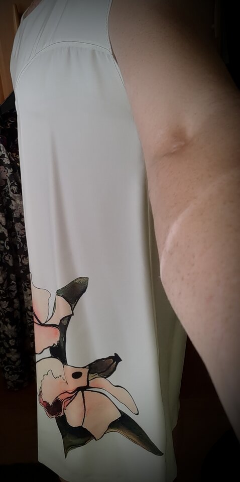 20200710_084533.jpg - Palciusia