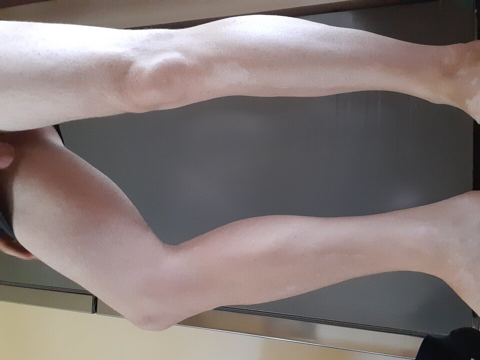 15947065654578928522762417107602.jpg - Palciusia