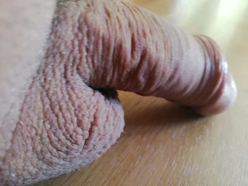 IMG_20200715_092906.jpg - wirus101