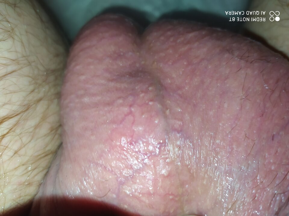 jajka też zgubiły - RPGfan