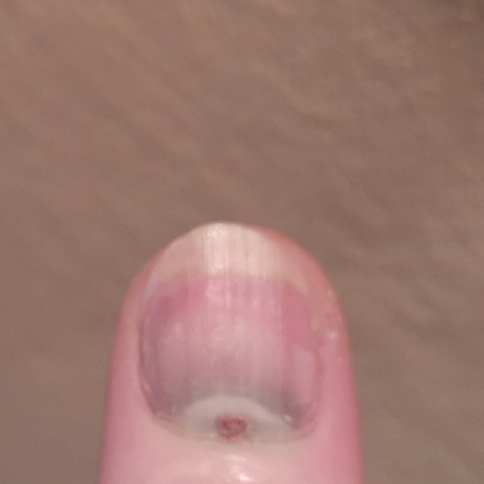 20200730_205949.jpg - Palciusia