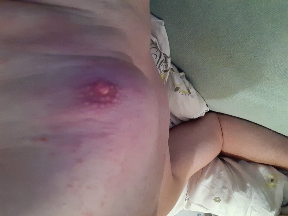 1596307629039818051820707136805.jpg - Palciusia