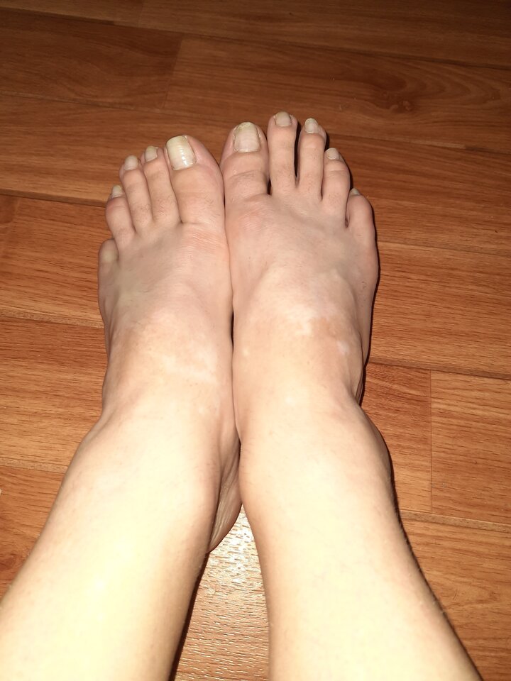 1596655099005102049816790452342.jpg - Palciusia