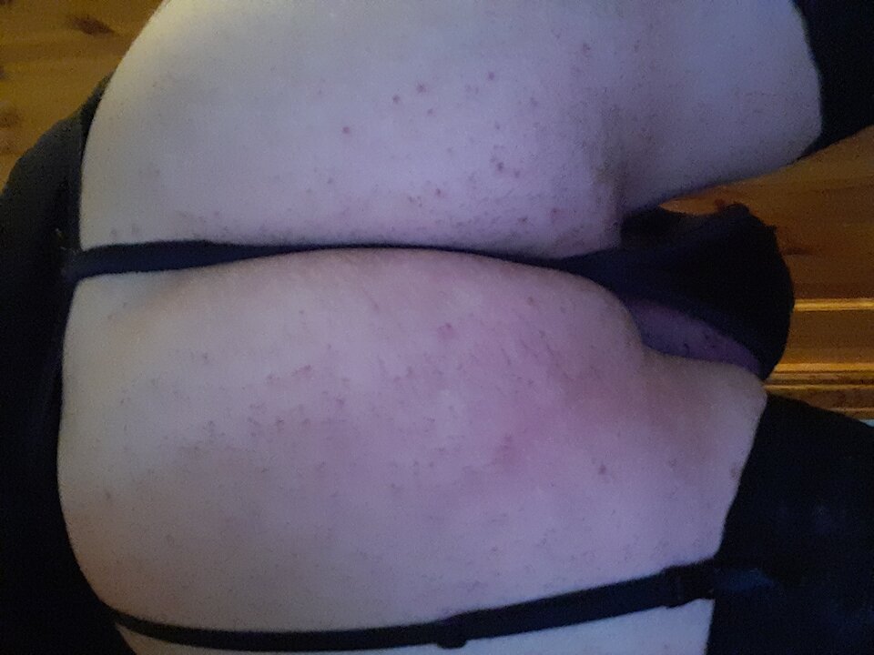 15967435395582824151396417676933.jpg - Palciusia