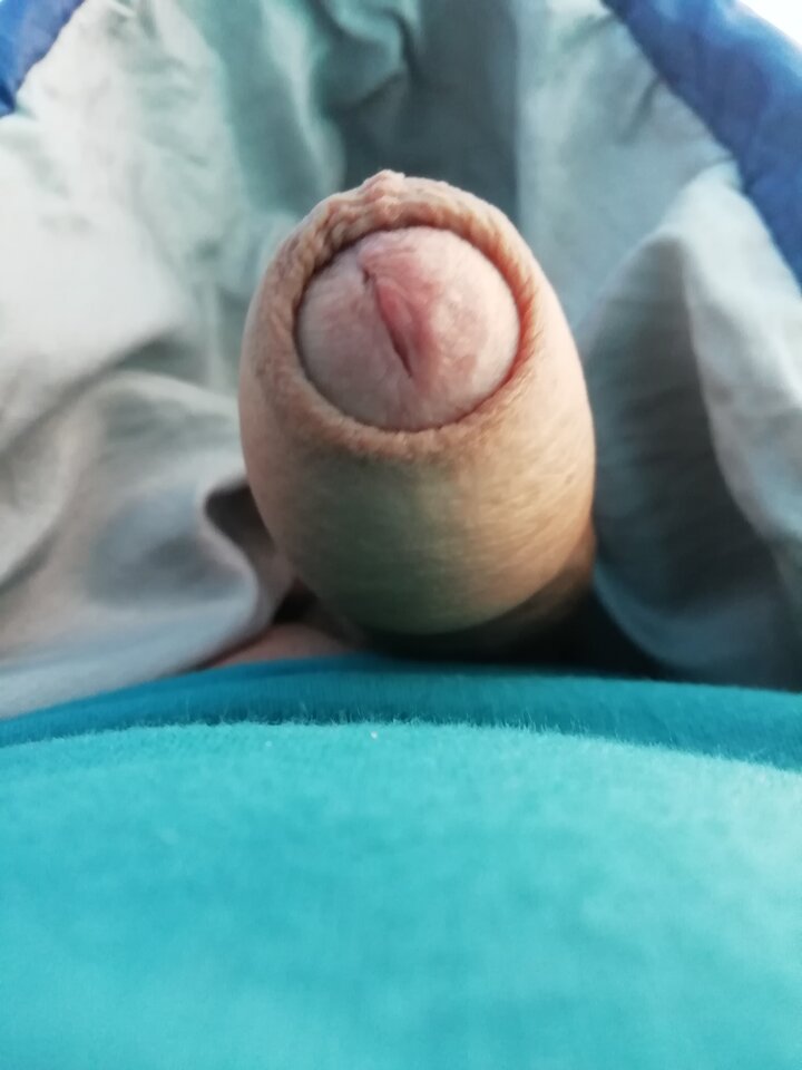 IMG_20200807_074534.jpg - wirus101