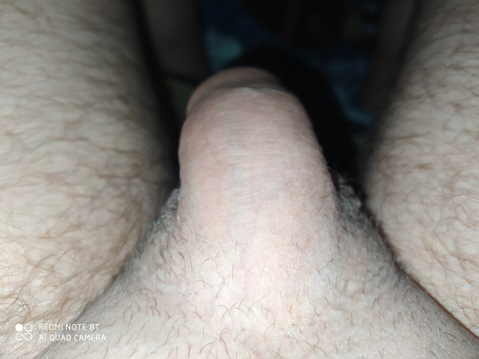 Chyba czas go ogolić ? - RPGfan