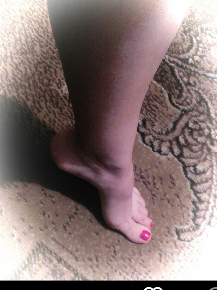 20200811_094416.jpg - Lekkopuszysta77