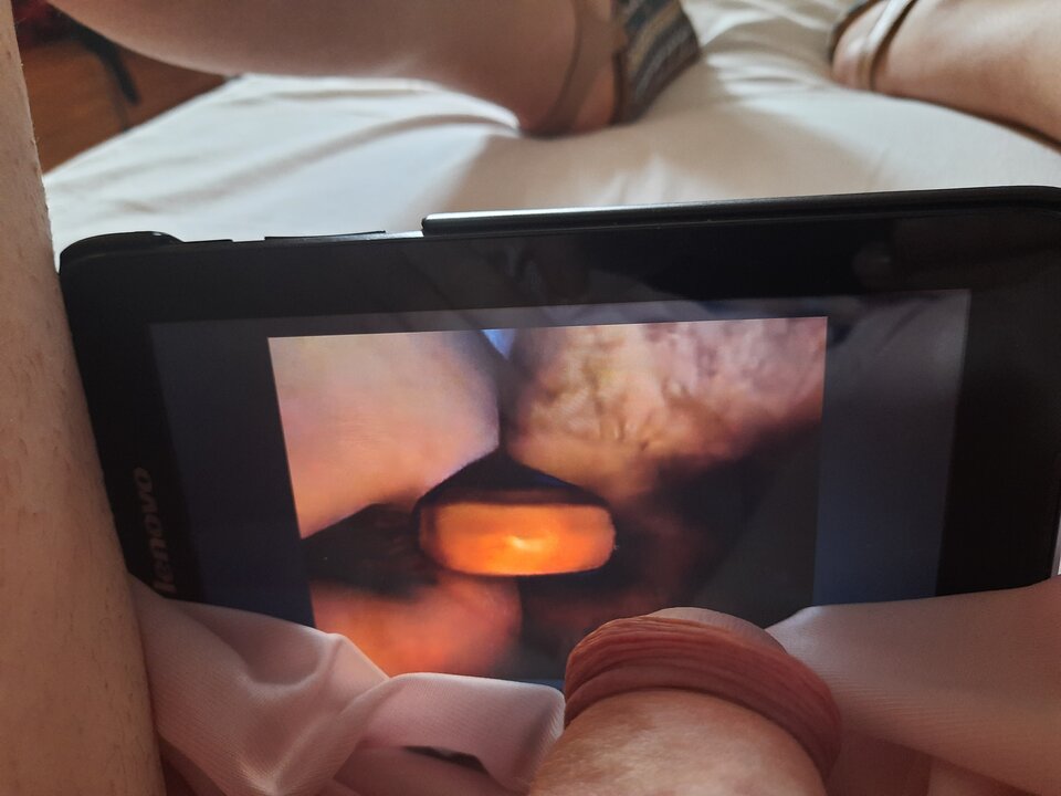 1597574503795166105481124628739.jpg - Palciusia