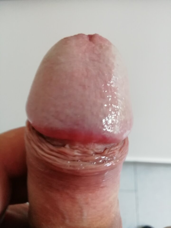 IMG_20200820_145410.jpg - wirus101