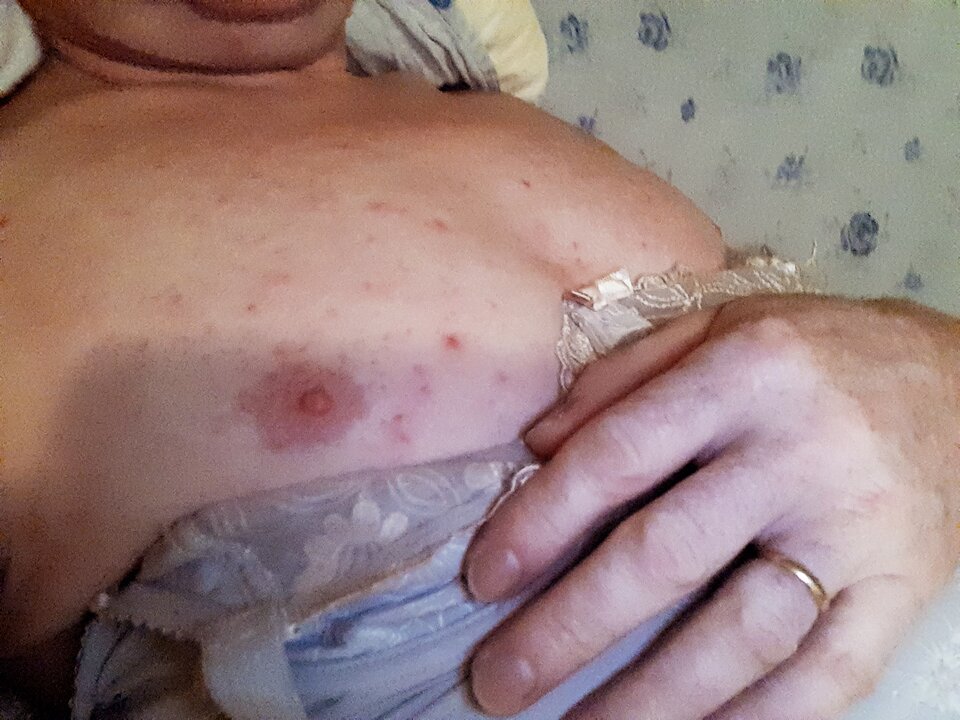 15980414100941601271701812709894.jpg - Palciusia