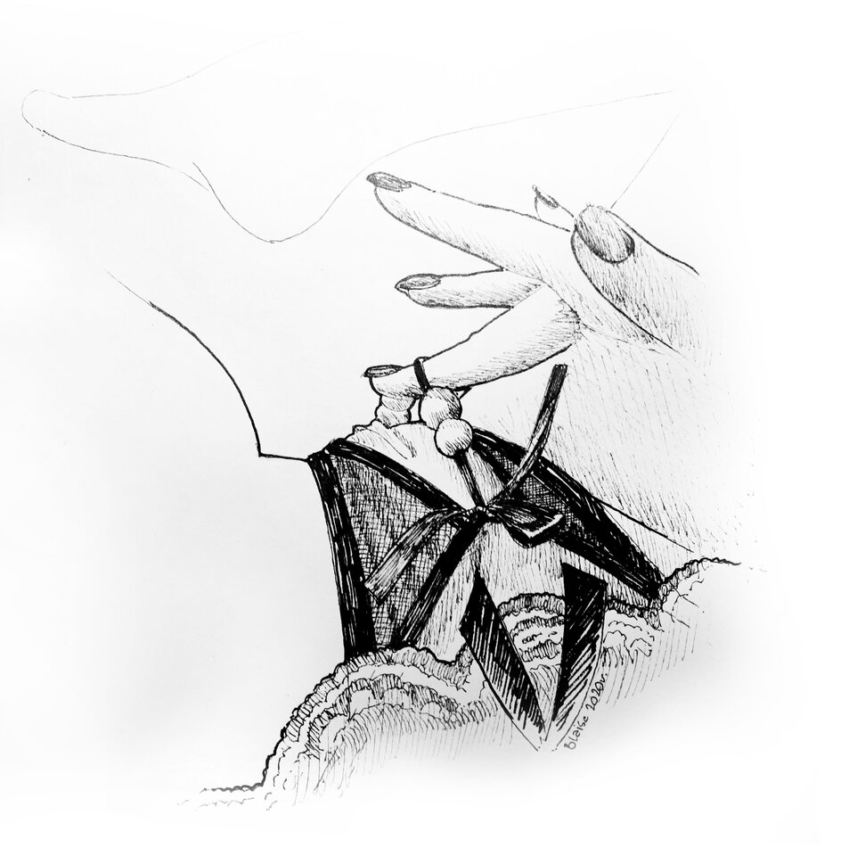Art no.34 - blaise8