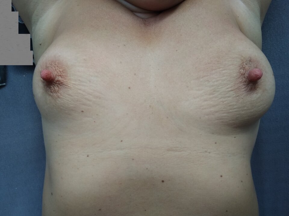 IMG_20200702_071301.jpg - ciupciup6474