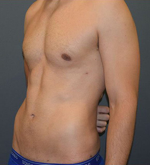 before-1.jpg - olej31