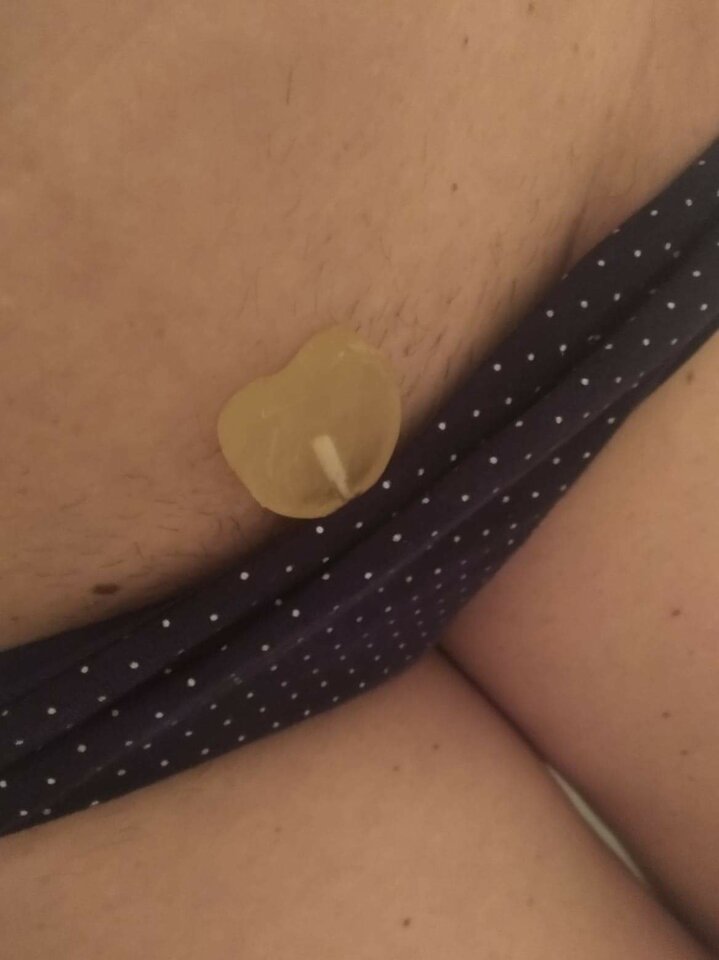 received_1583040705200716.jpeg - rudaaska