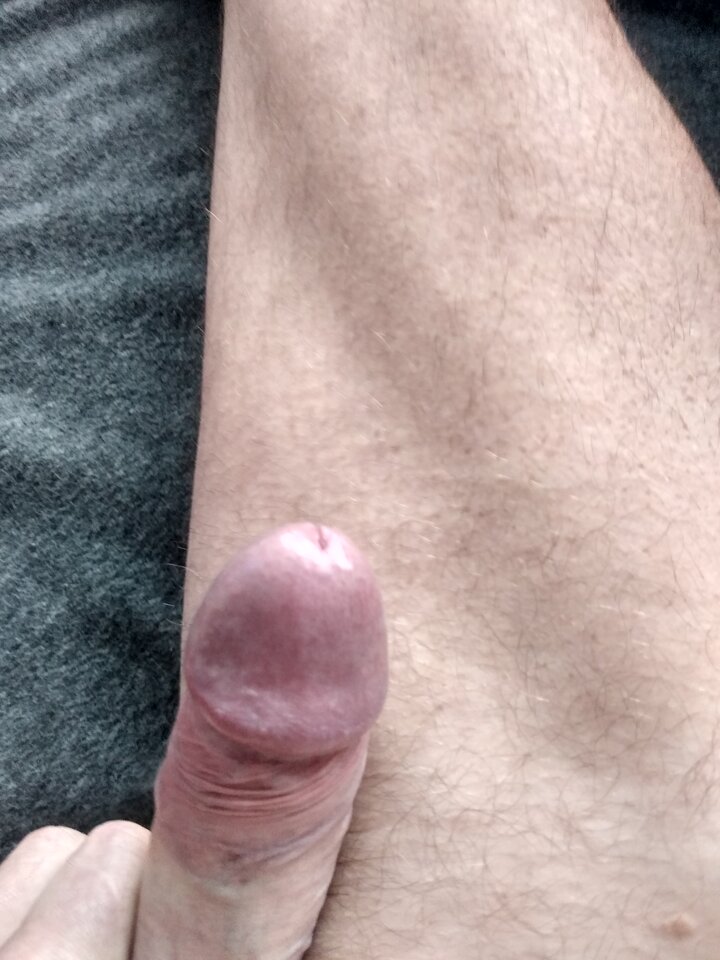 16011924006107578989724793830281.jpg - twoeyes