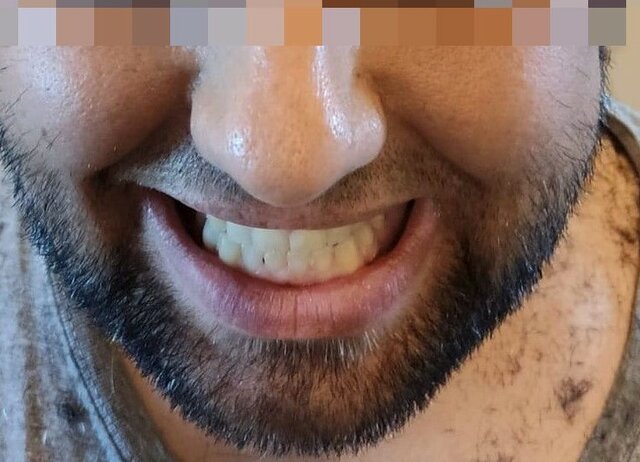 111 (2).jpg - ACID22