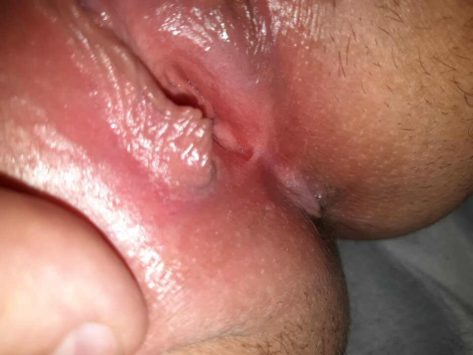 20201203_152438.jpg - luck1975