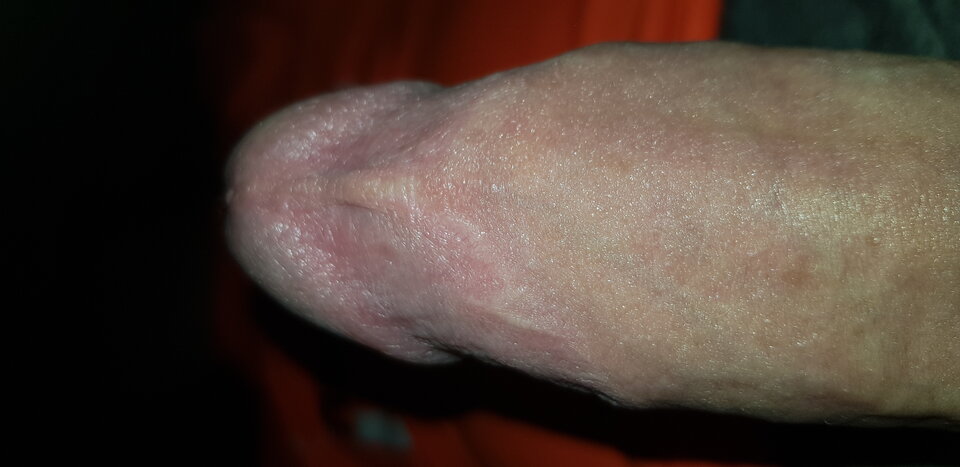 20201205_225034.jpg - RYSIO666