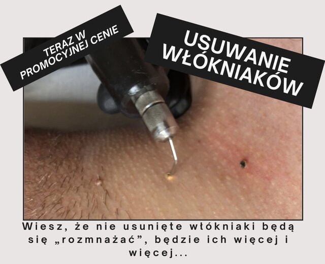 203CDDC6-666D-4121-8567-180190D5BBB0.jpeg - MagdaCzarek