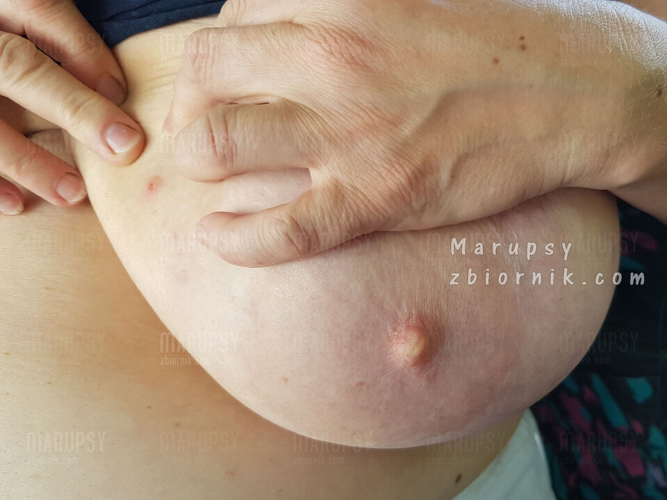 20200614_150240.jpg - Marupsy