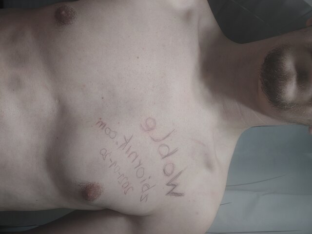 Woble
