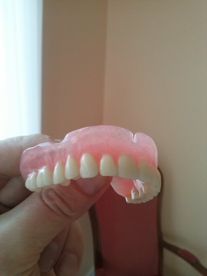 CAM00236.jpg - ProtezyFetysz