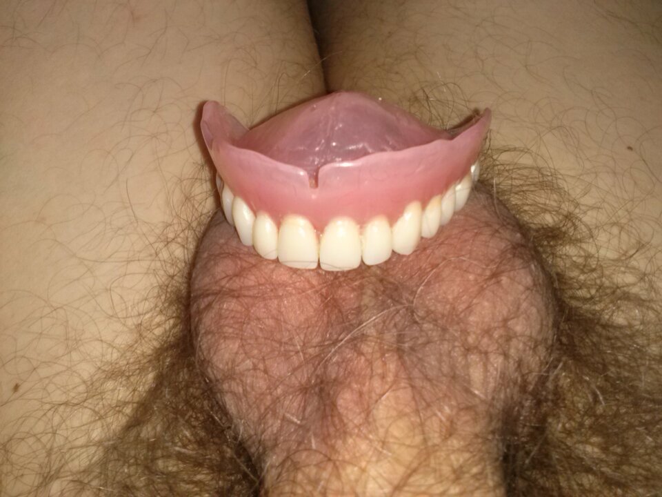 CAM00260.jpg - ProtezyFetysz