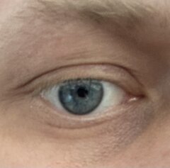 blue eye 