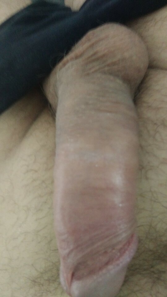 P_20200528_145531.jpg - parka_8180