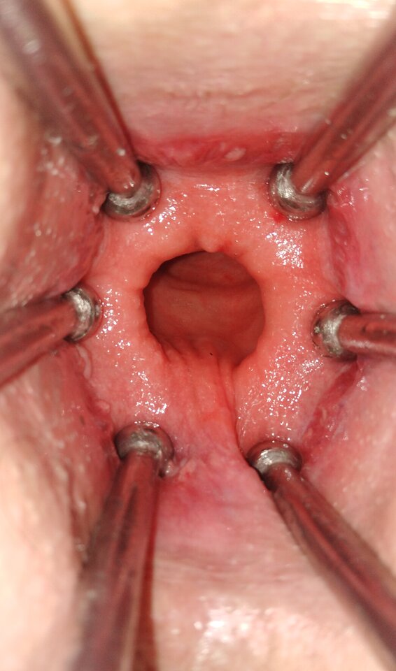 IMG_2021 - onaioncross