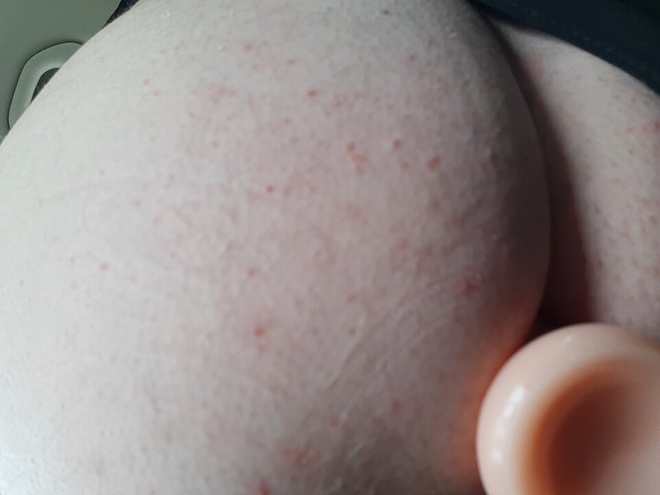 16201302029144480786129966689957.jpg - Palciusia