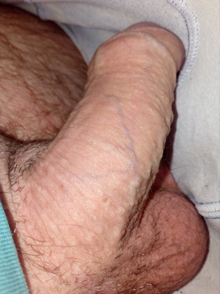 IMG_20210525_211639.jpg - Cycus7788