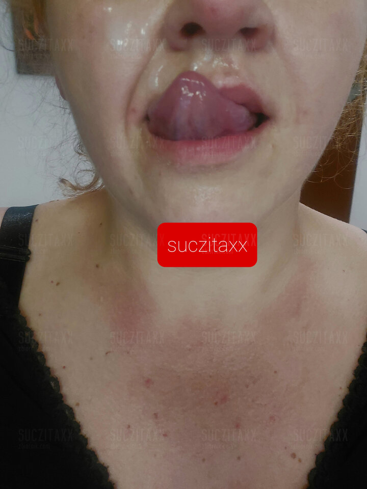 20210525_101738.jpg - Suczitaxx