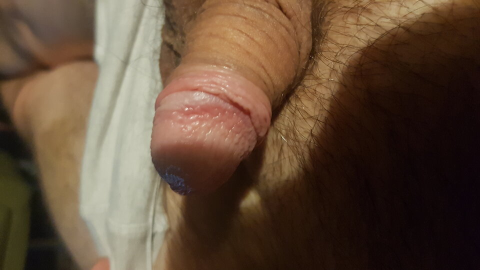 16244856818382891413087234183062.jpg - Dzikusowy