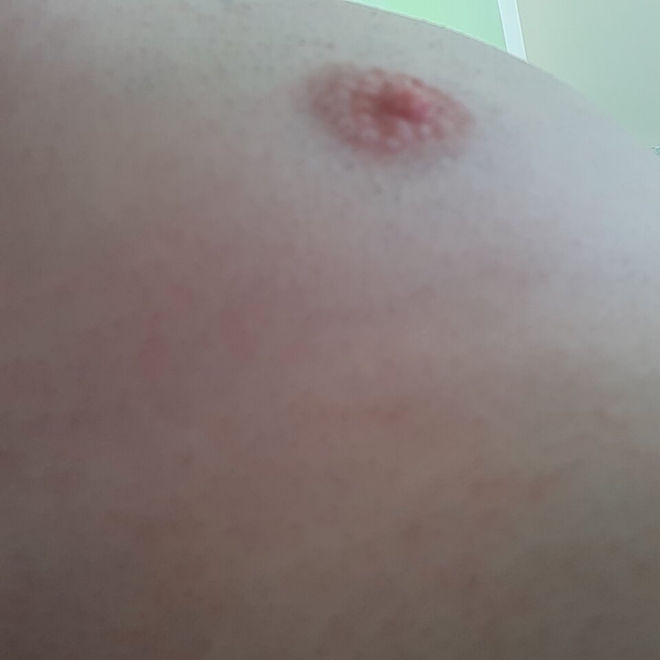 16247717210478388801035365624201.jpg - Palciusia