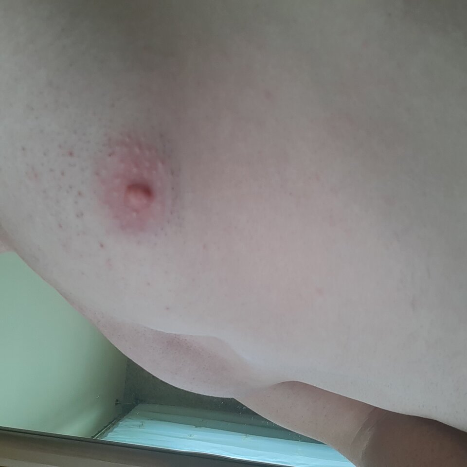 16247722299557962318161538585574.jpg - Palciusia