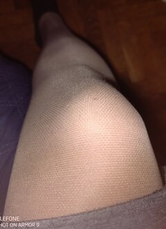 Przeciw żylakowe( ccl2)